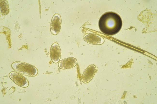 Strongylate eggs.