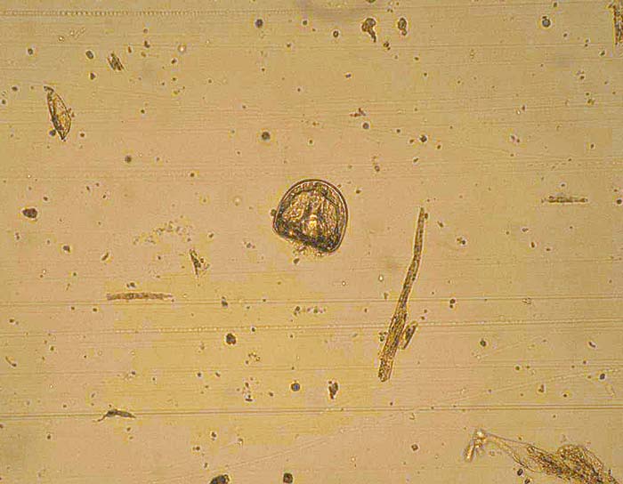 A tapeworm egg.