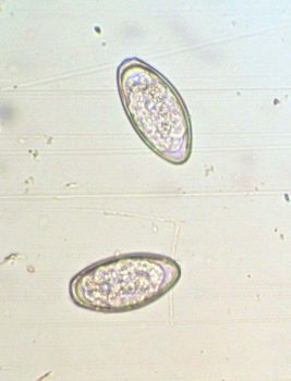 Oxyuris close up.