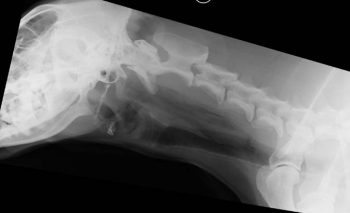 Figure 1. Conventional radiograph, lateral cervical view, showing evidence of free gas within the fascial planes following an acute oropharyngeal stick injury.