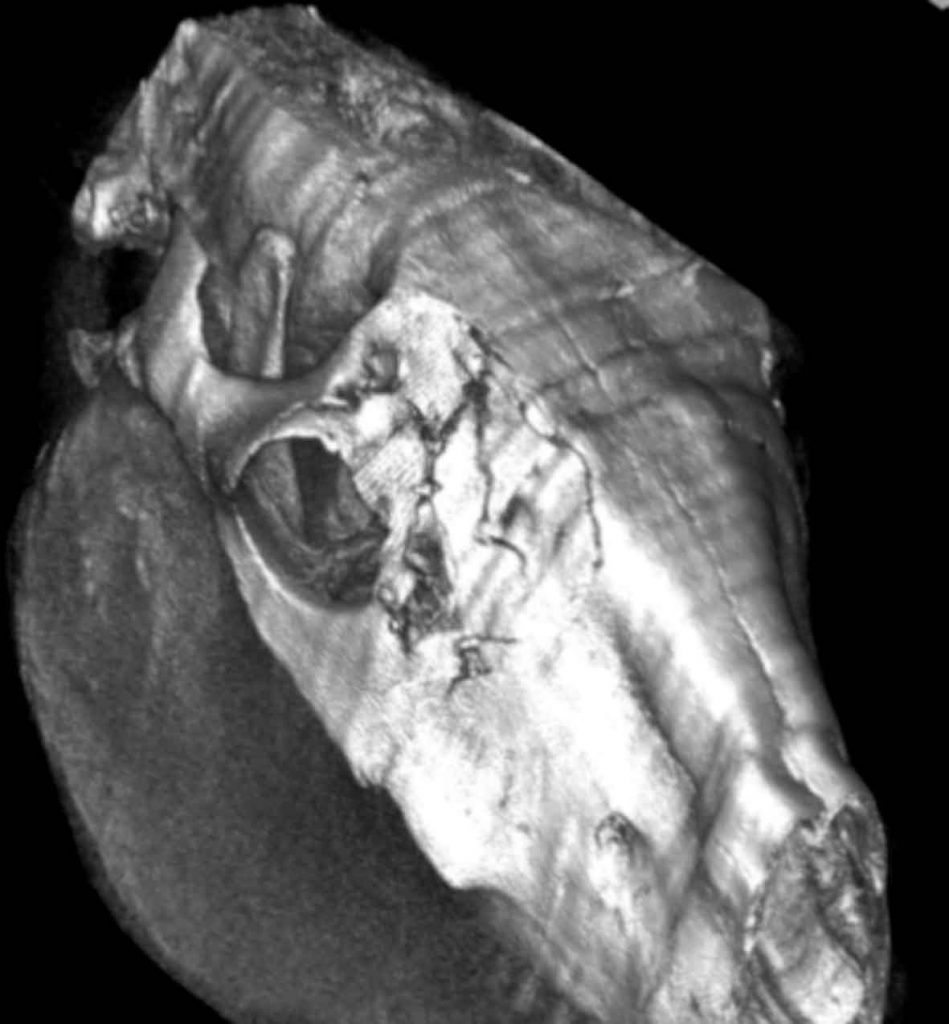 Figure 5. 3D reconstruction of a CT scan from a horse with a wound to the head. There is a complex fracture to the frontal and maxillary bones, along with a periorbital fracture. The fracture was repaired under general anaesthesia and the wound healed successfully.