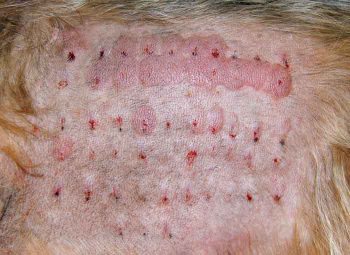 Figure 4. An intradermal test with positive reactions demonstrating an environmental allergy.