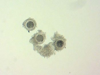 Figure 4. COC after collection. A good layer of cumulus cells are present.