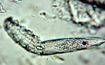 Figure 2. Demodex canis mite taken from skin scraping from a dog.