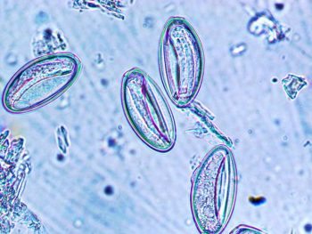 Figure 4. Oxyuris equi eggs magnified ×40.