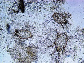 Figure 2. Chorioptes mites collected in superficial brushings and scrapings from the distal limb.