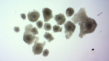 Figure 6. A mixture of good and poor-quality cumulus-oocyte complexes (COC) aids development. Good quality COC can be seen with a thick layer of cumulous cells; poorer quality COC have a thin layer of cumulus cells.