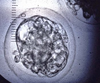 Figure 7. A good quality early blastocyst embryo for transfer or freezing. 