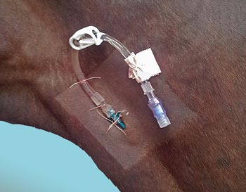 Figure 3. A jugular catheter.