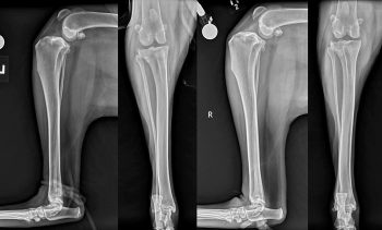 Figure 2. Orthogonal views of both stifles of a two-year-old Newfoundland that presented with bilateral pelvic limb lameness of acute onset with no history or evidence of trauma. The dog was diagnosed with bilateral degenerative cranial cruciate ligament disease. The radiographs show evidence of periarticular osteophytosis, synovial effusion and cranial displacement of the tibia relative to the femur, more severe on the right than on the left.