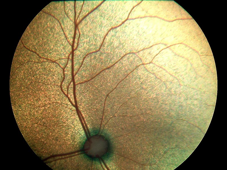 Figure 3. Normal feline fundus, demonstrating characteristic unmyelinated optic nerve, paired dorsomedial, ventromedial and ventrolateral retinal veins, and arterioles. The optic nerve in cats is located in the tapetal portion of the retina. Not pictured in this image is the ventral non-tapetum. IMAGE: Jenny Carter and Craig Irving.