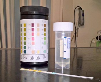 Figure 2. Lolan's urine sample.
