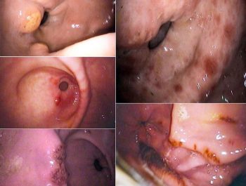 Figure 3. A collection of images showing a range of glandular lesions that can be identified with gastroscopy in the horse. 