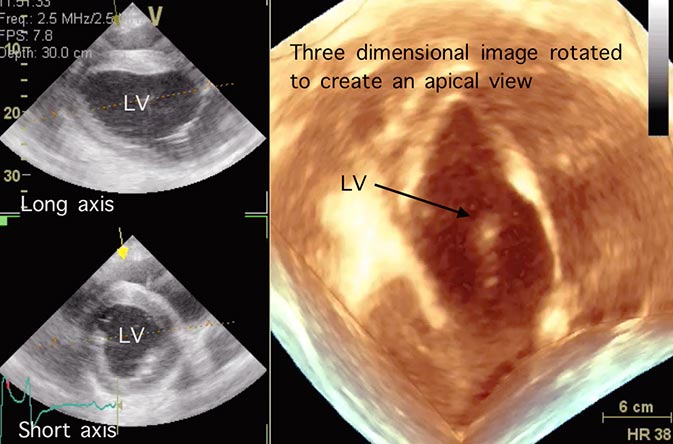 Figure 6a. Three-dimensional echocardiography processing a large data dataset collected over several heart beats. For the first time, it is possible to manipulate these data to create apical images in adult horses. LV = left ventricle.