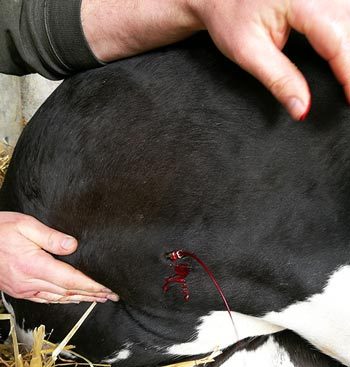 Correct placement of a needle in the jugular vein.