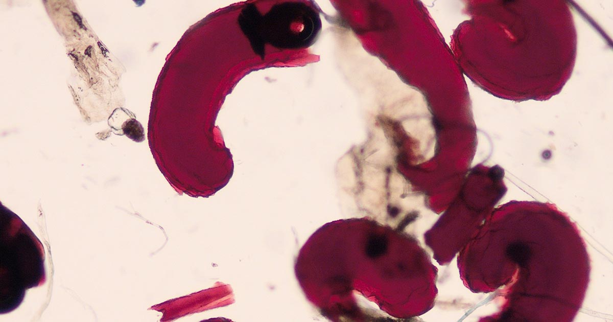 Figure 1. Flea infestation and flea allergy dermatitis are common triggers for pyotraumatic dermatitis. This image shows abundant flea faeces from a coat brushing.