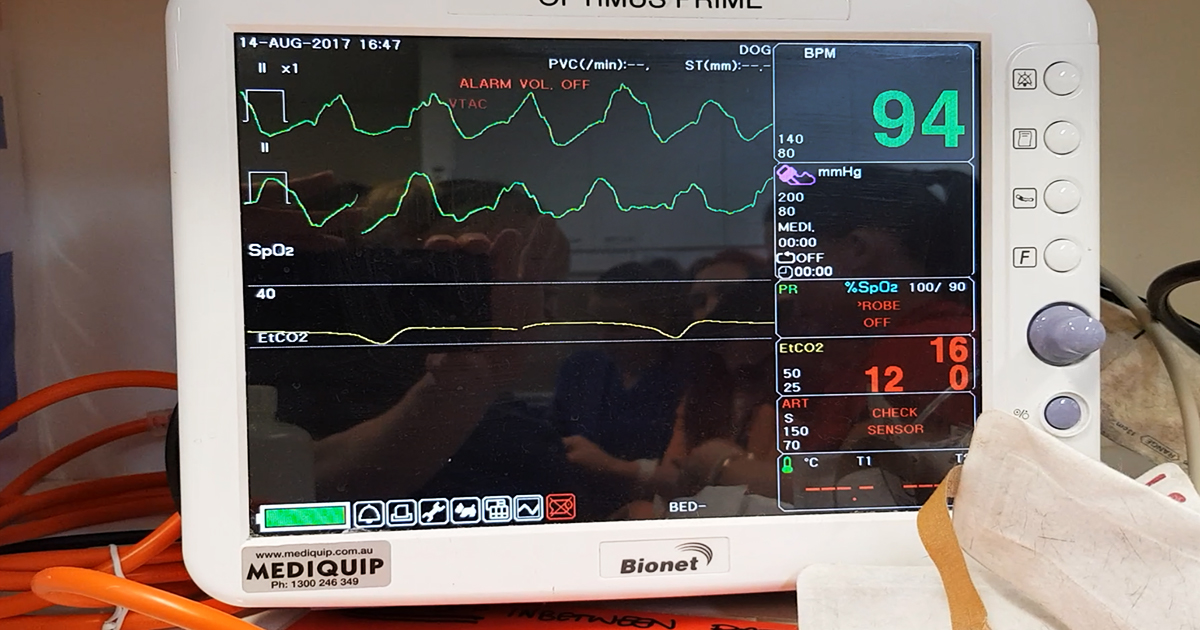 ECG is good for identifying initial arrest rhythm patterns and ongoing monitoring of patients.