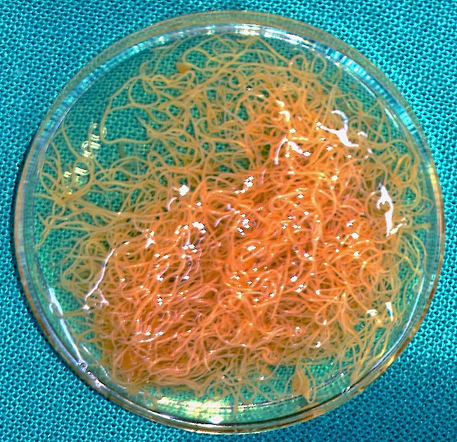 Figure 1: Adult Haemonchus nematodes recovered from the abomasum of cattle.