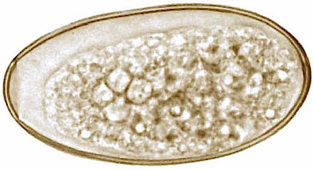 Figure 5. An egg of the genus Fasciola liver fluke.