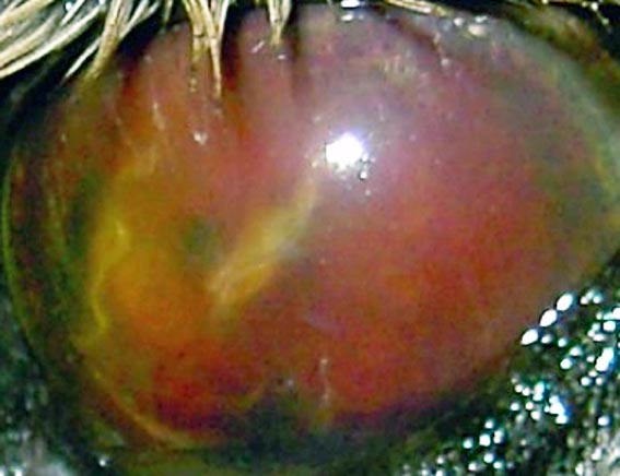 Figure 1. Blood and fibrin within the anterior chamber obstructing further visual assessment of the eye.