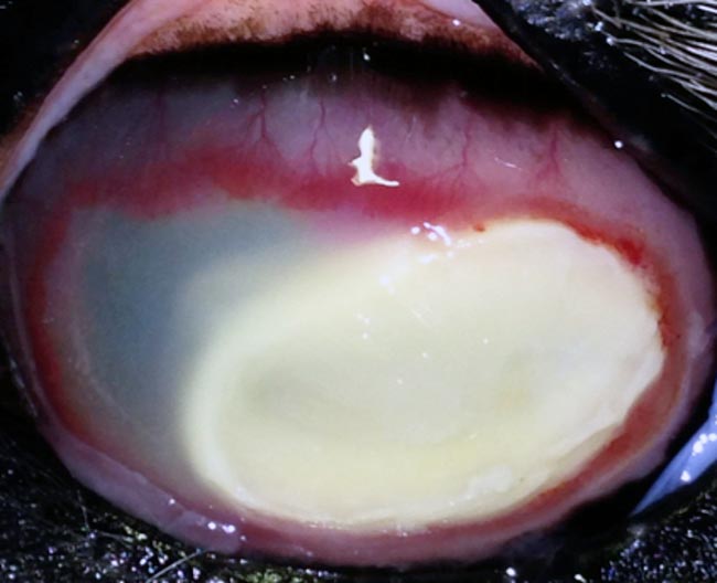 Figure 3a. Severe keratitis.