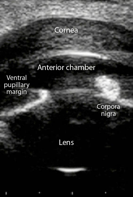 Figure 3b. A vertically oriented ultrasound image revealing a markedly thickened cornea (5mm) with a surprisingly clear anterior chamber, reasonable pupillary size and normal lens. This horse made a full recovery.