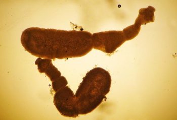 Echinococcus granulosus adult tapeworms. IMAGE: John McGarry, University of Liverpool.