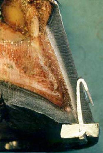 Figure 3. Infection can trap in the underlying dermal layers of the hoof wall following injury.