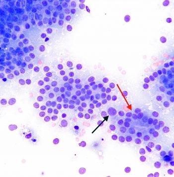 50× image from a rapidly growing mass in the anal sac of an adult male English cocker spaniel.