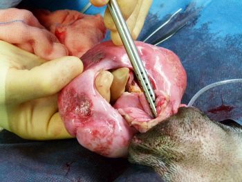 Figure 5. Circumferential incision of a type III vaginal fold prolapse. IMAGE: Benito de la Puerta.