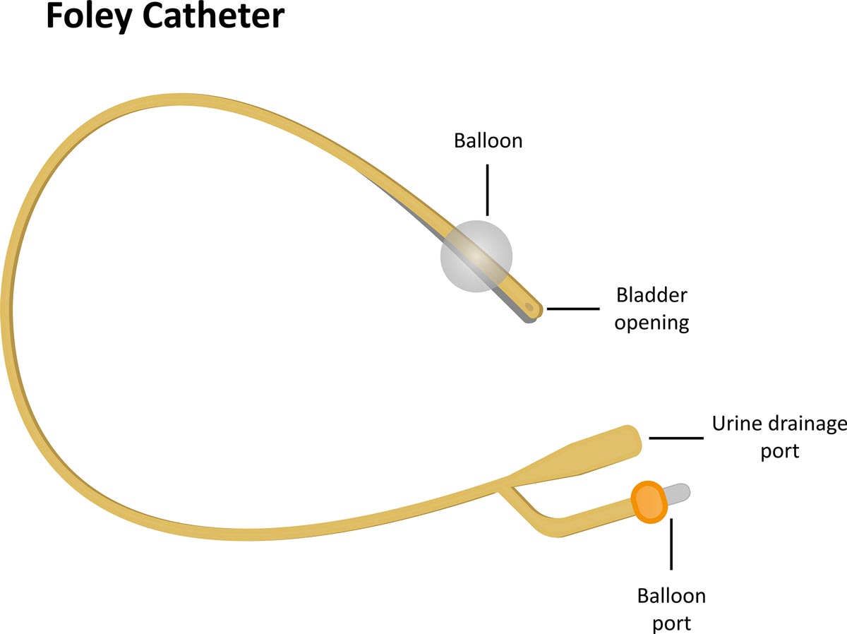 Foley catheter