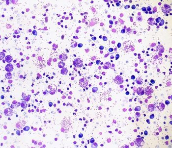 10× and 50× images from the lymph node aspirate of an adult male dog.