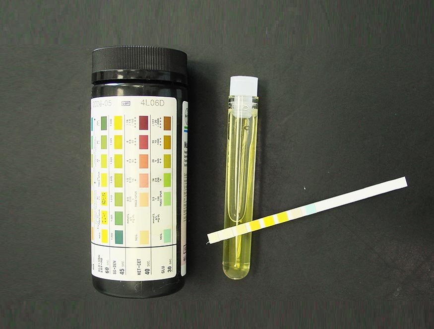 Urinalysis