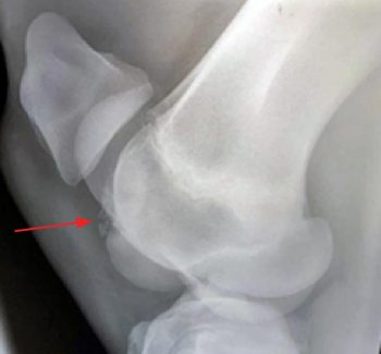Figure 4a. A lateromedial radiograph of the right stifle of a Thoroughbred yearling, demonstrating osteochondritis dissecans of the lateral trochlear ridge of the femur.