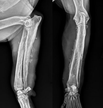 Figure 3. Craniocaudal (left) and mediolateral (right) views of the right antebrachium of a five-year-old dog presented for assessment of a right thoracic limb lameness that had failed to respond to medical management with NSAIDs. A moderate amount of irregular palisading periosteal proliferation is noted circumferential to the right radius and ulna. This is most severe along the medial cortex of the radius, with smoothly marginated periosteal proliferation and multiple areas of palisading, pedunculated proliferation extending into the soft tissues medial to the proximal aspect of the radius through the distal diaphysis. Similar irregular palisading periosteal proliferation is noted along the caudal aspect of the proximal ulna through the distal diaphysis of the ulna. More smoothly marginated periosteal proliferation is noted along the lateral aspect of the distal ulna, with slightly irregularly marginated periosteal proliferation along the cranial aspect of the distal radius. Irregular, palisading periosteal proliferation is also noted on the proximal and caudal aspect of the accessory carpal bone. Although the majority of the osseous changes are proliferative, permeative lysis exists in the distal ulnar diaphysis. The soft tissues circumferential to the radius and ulna are severely thickened, especially medial to the proximal radius, and medial the distal radius. A 4mm rounded osseous opacity exists in the soft tissues medial to the distal radius. The craniocaudal projection shows very subtle periosteal proliferation along the medial humeral epicondyle. These findings were consistent with a diagnosis of osteomyelitis and biopsies were taken. The final diagnosis was radioulnar actinomyces osteomyelitis. 