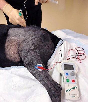 Figure 2. Peripheral nerve stimulator being used for a femoral nerve block using the preiliac approach.