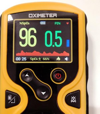 Figure 3. Pulse oximeter with perfusion index.