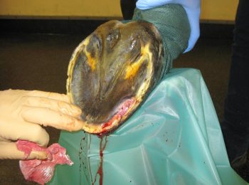 Figure 6a. Debridement of the laminar tissue initially via a solar approach.