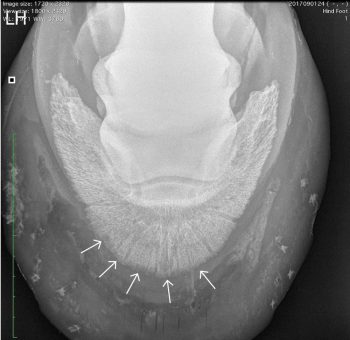 Figure 1. Non-septic pedal osteitis secondary to laminitis.