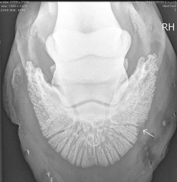 Figure 2. Upright pedal radiograph of a horse with repeated abscessation at the dorsolateral white line, showing a small area of radiolucency in the solar margin of the distal phalanx adjacent to the tract.