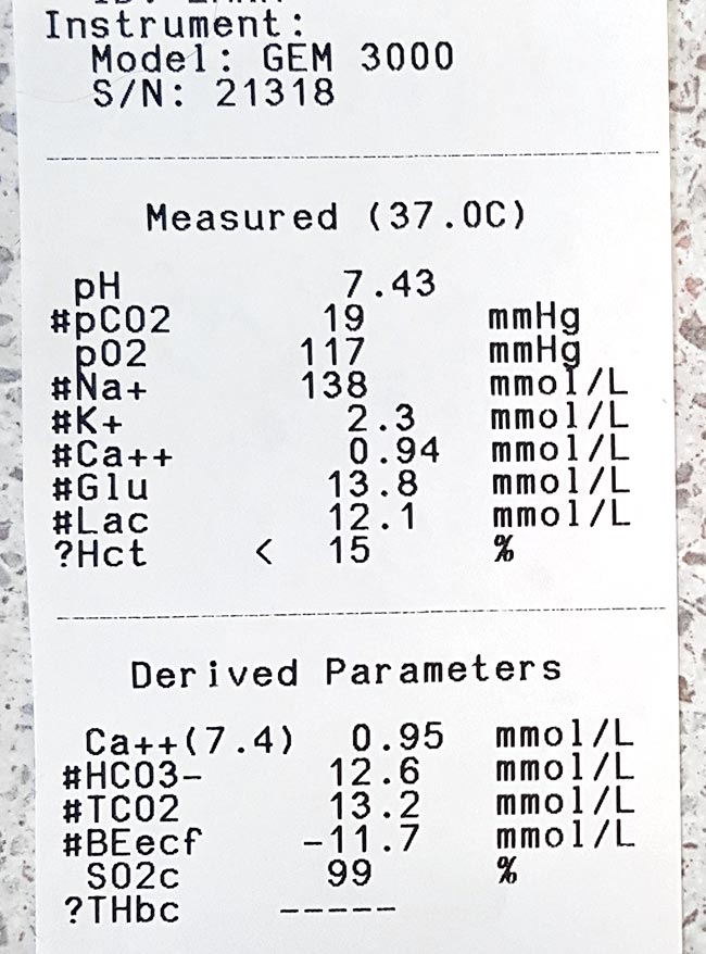 An example of low ionised calcium.