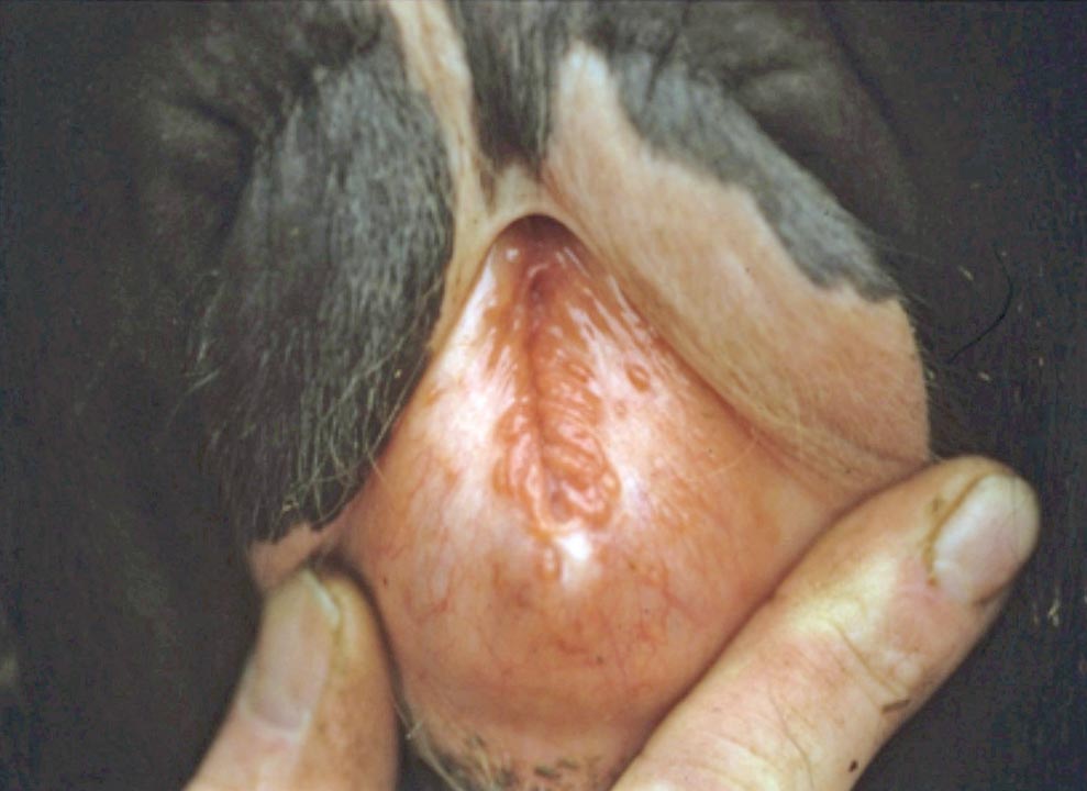 Figure 3. Infectious pustular vulvovagintis – papules/pustules and oedema in the vulva.