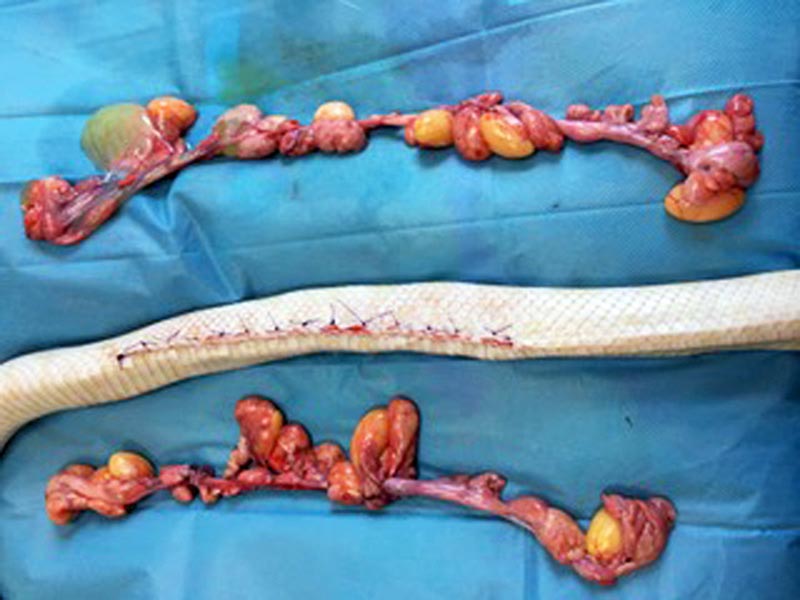 Figure 2. The diseased ovarian tissue and closed surgical site.