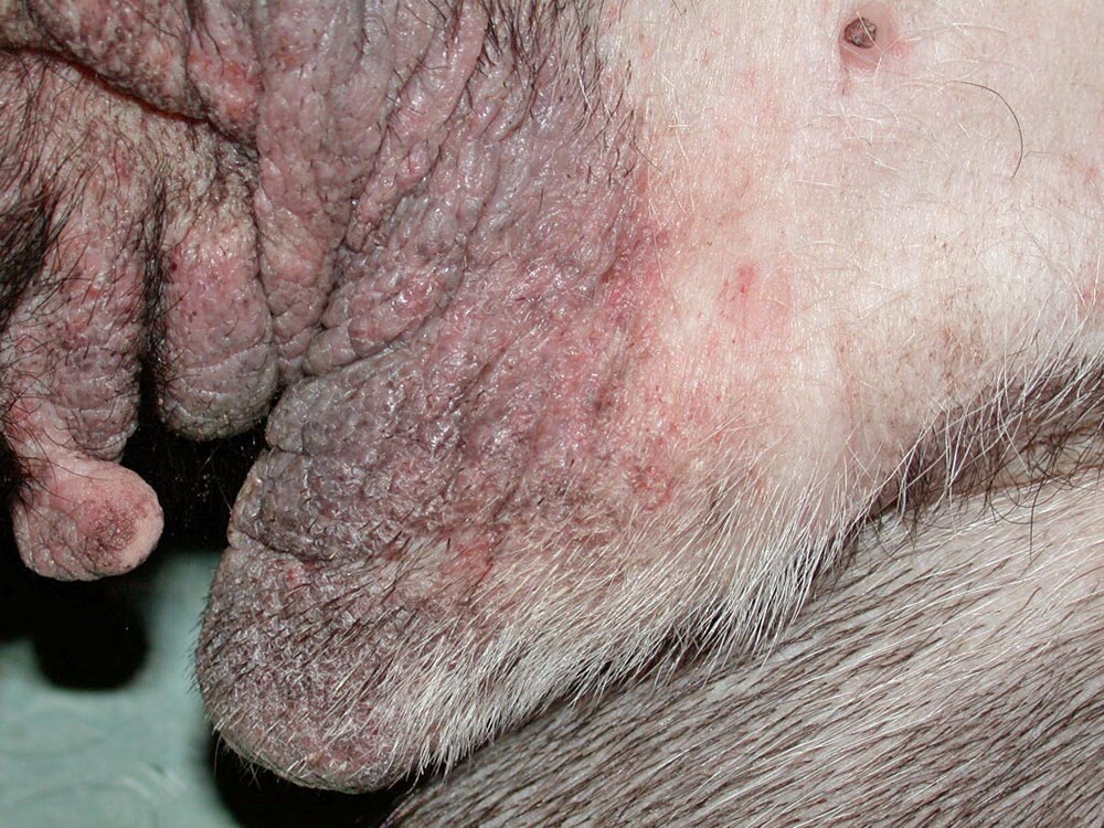 Figure 6. Severe lichenification and hyperpigmentation in the preputial region in a dog with atopic dermatitis.