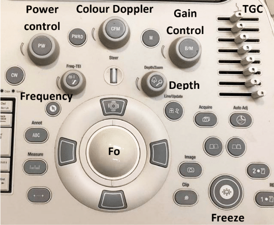 Ultrasound control panel.