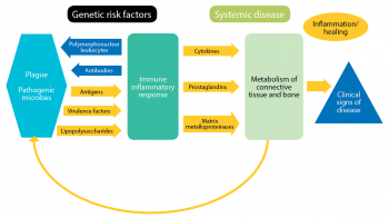 A diagram showing the pathogenesis of periodontal disease.