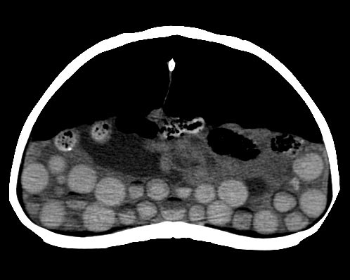 Figure 1. A CT scan demonstrating follicles.