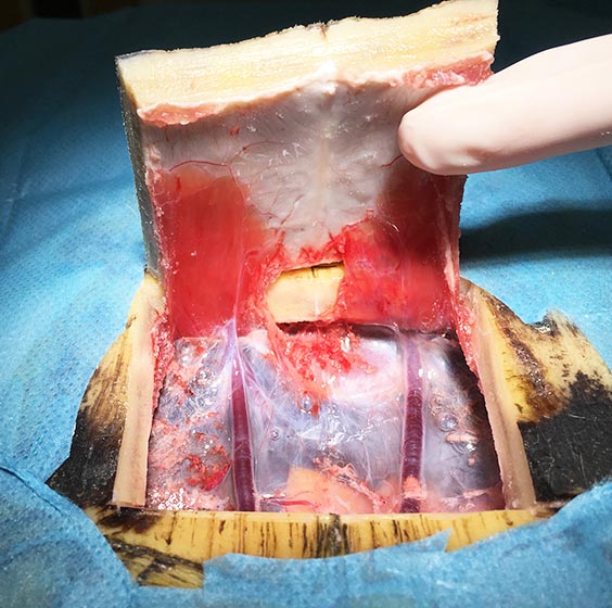Figure 3a. The incision between the abdominal blood vessels to enter the coelomic cavity.