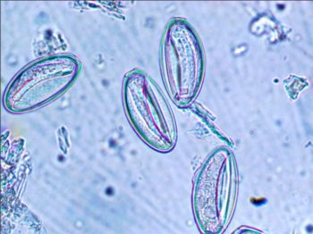 Figure 4b. Oxyuris eggs visible on a sticky tape strip applied to the perianal area.