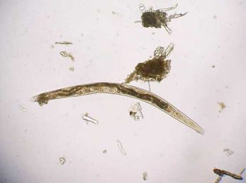Figure 1. Free-living soil nematode.